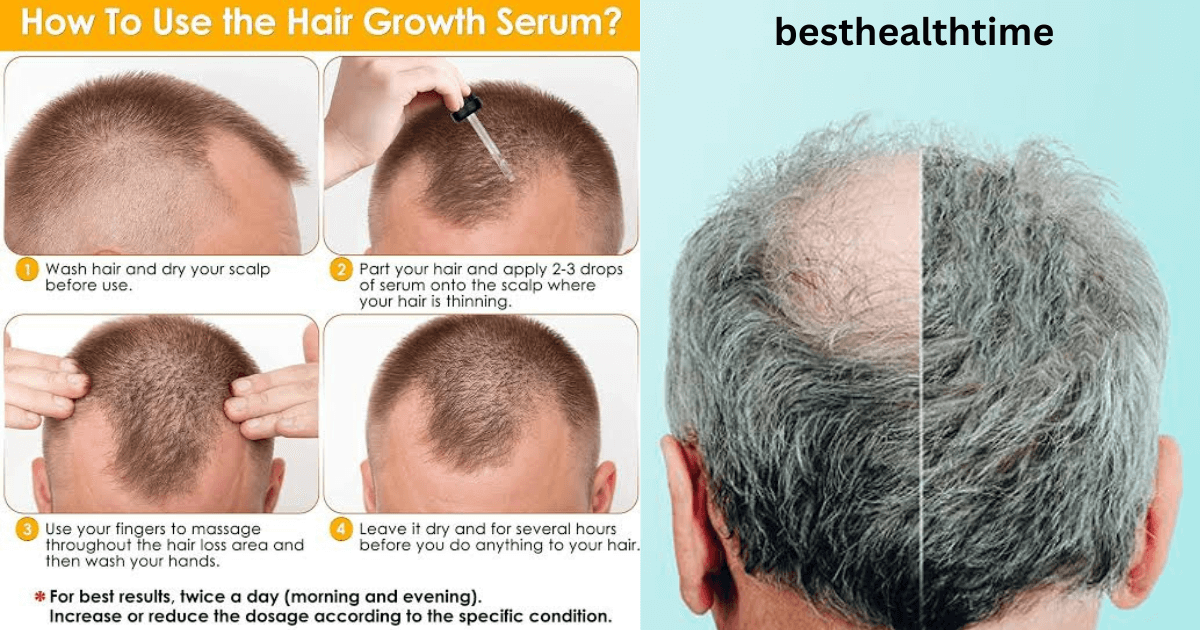 7 day serum for hair regrowth दोबारा बालों को पुनर्विकास कर सकते हैं